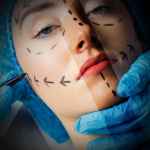  Секрет естественного вида подтяжки лица