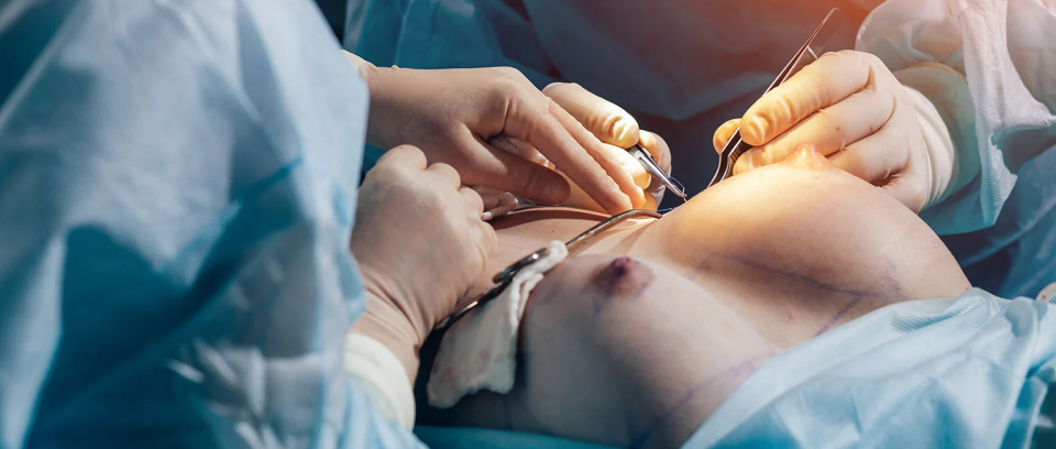 Этапы заживления разрезов после увеличения груди