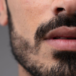 Все больше мужчин обращаются к эстетической медицине