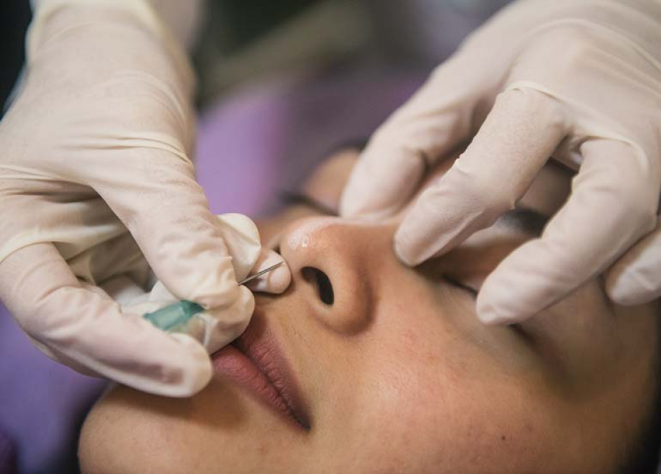 Нехирургические способы поднять кончик носа