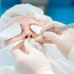 Мурманские хирурги осваивают ультразвуковую риносептопластику