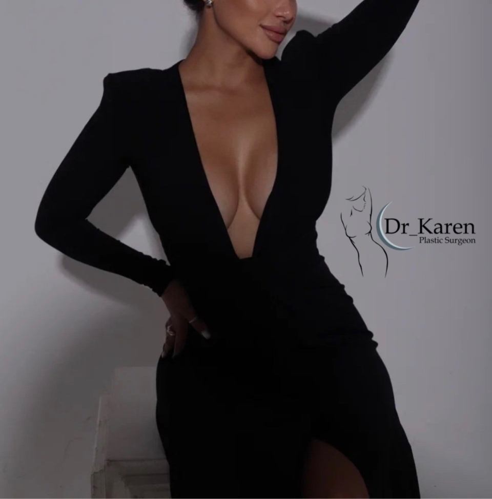 Пациентка доктора Карена после увеличения груди имплантами. Фотоотзыв