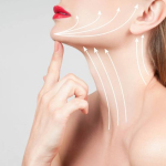 липомоделирование подбородка