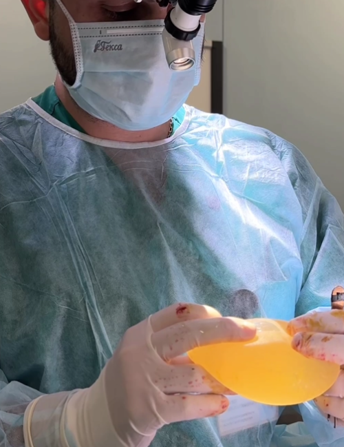 Имплант через 15 лет после установки