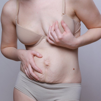 Спрос на послеродовую коррекцию вырос на 40%»